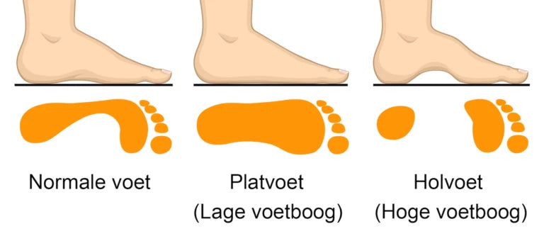 verschillende voeten met voetklachten